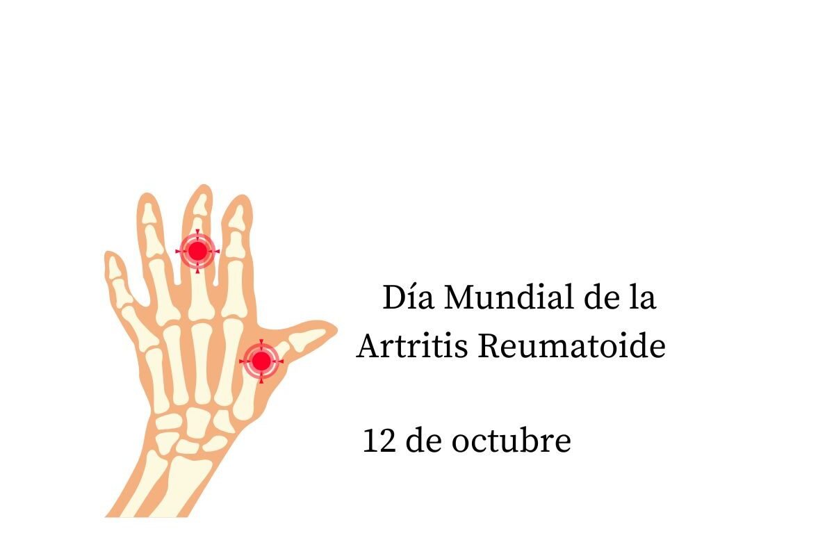 día mundial del lupus se celebra el 10 de mayo (2)